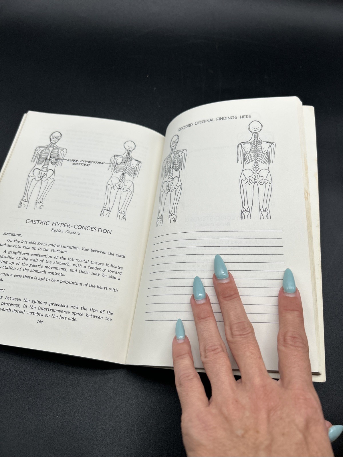 Chapman, Frank: AN ENDOCRINE INTERPRETATION OF CHAPMAN&rsquo;S REFLEXES 1969 SC Book