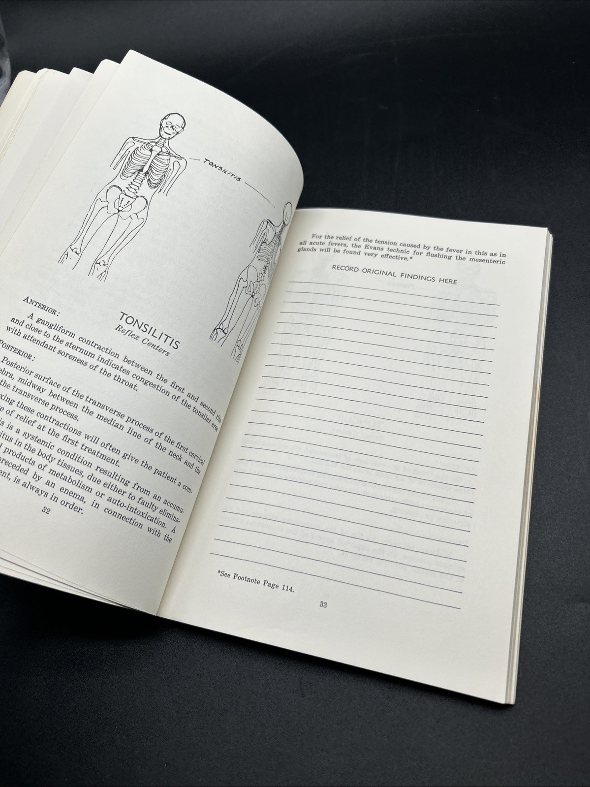 Chapman, Frank: AN ENDOCRINE INTERPRETATION OF CHAPMAN&rsquo;S REFLEXES 1969 SC Book