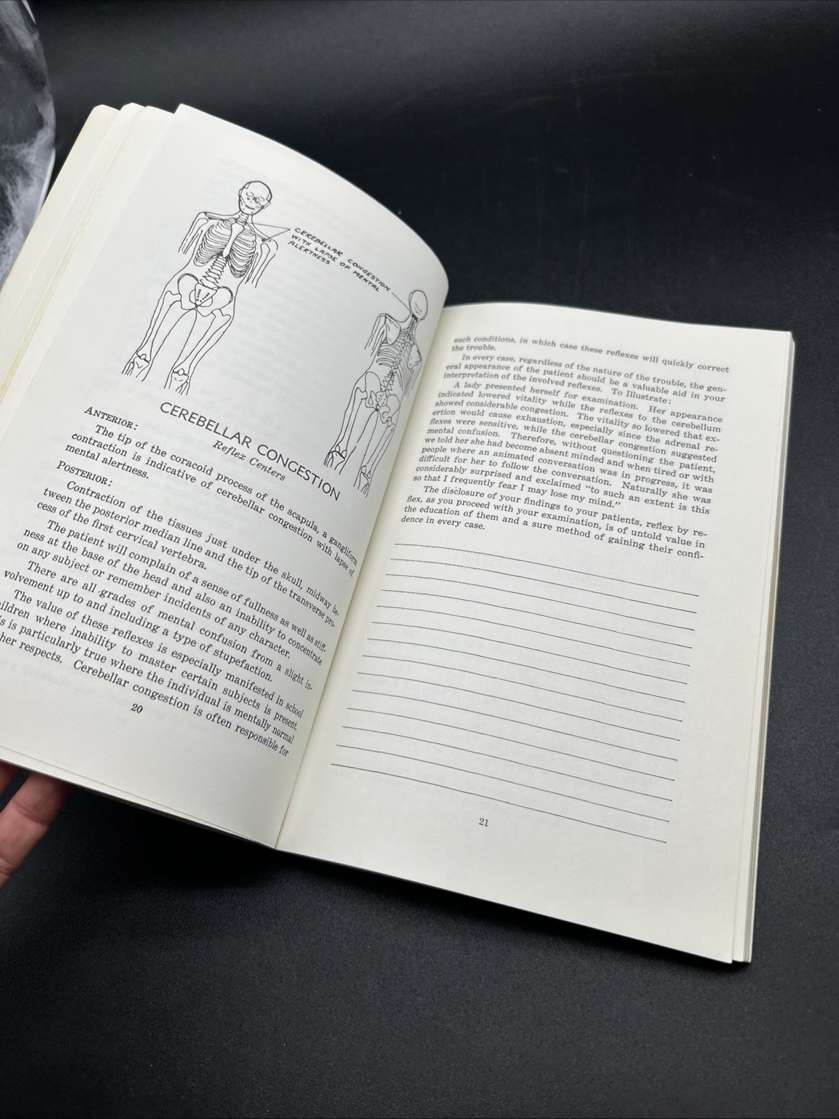 Chapman, Frank: AN ENDOCRINE INTERPRETATION OF CHAPMAN&rsquo;S REFLEXES 1969 SC Book