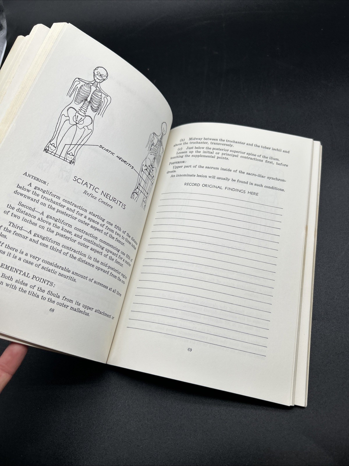 Chapman, Frank: AN ENDOCRINE INTERPRETATION OF CHAPMAN&rsquo;S REFLEXES 1969 SC Book