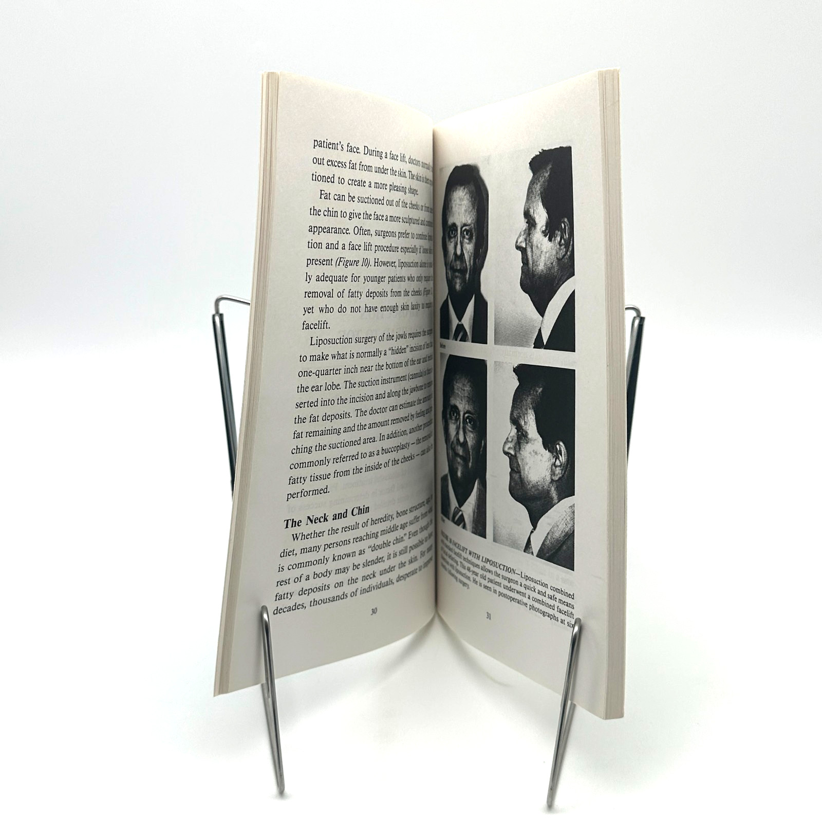 Body Sculpturing Wesley Harline 1996 Cosmetic Surgery Liposuction Guide Photos